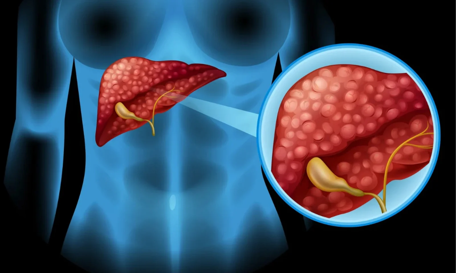 Liver Health का कैसे रखे ध्यान अपनाए आसान से उपाय जो बदल देंगे आपकी लाइफ